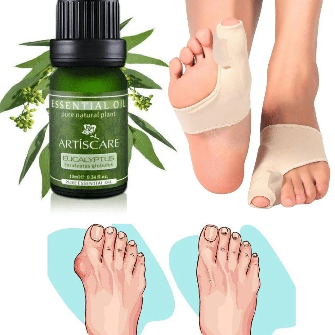 Rosemary Bunion Protector Essential Oil